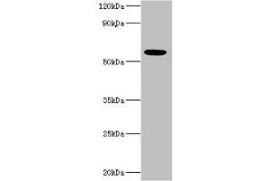 Western blot All lanes: IFNAR2 antibody at 10 μg/mL + MCF-7 whole cell lysate Secondary Goat polyclonal to rabbit IgG at 1/10000 dilution Predicted band size: 58, 38, 28 kDa Observed band size: 58 kDa (IFNAR2 antibody  (AA 27-243))