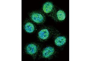 Confocal immunofluorescent analysis of ALOX15 Antibody (C-term) (ABIN392383 and ABIN2842014) with hela cell followed by Alexa Fluor 488-conjugated goat anti-rabbit lgG (green). (ALOX15 antibody  (C-Term))