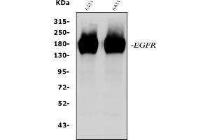 Western blot analysis of EGFR using anti-EGFR antibody (ABIN5518909). (EGFR antibody  (N-Term))