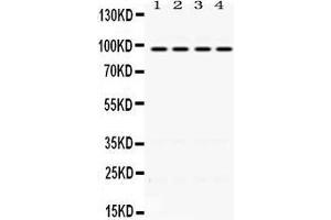 Western Blotting (WB) image for anti-Programmed Cell Death 6 Interacting Protein (PDCD6IP) (AA 2-330) antibody (ABIN3043596) (ALIX antibody  (AA 2-330))