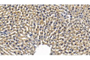 Immunohistochemistry (IHC) image for anti-TANK-Binding Kinase 1 (TBK1) (AA 9-310) antibody (ABIN7441433)