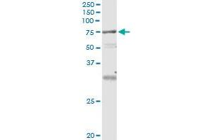 Immunoprecipitation (IP) image for anti-Vacuolar Protein Sorting 18 Homolog (VPS18) (AA 3-101) antibody (ABIN961169) (VPS18 antibody  (AA 3-101))