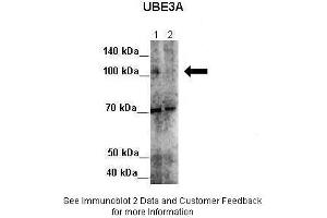 Western Blotting (WB) image for anti-Ubiquitin Protein Ligase E3A (ube3a) (Middle Region) antibody (ABIN2775648)