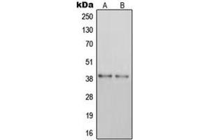 Western blot analysis of GPR105 expression in MDAMB435 (A), HEK293 (B) whole cell lysates. (P2RY14 antibody  (Center))