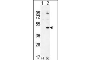 Western blot analysis of TGIF1 (arrow) using rabbit polyclonal TGIF1 Antibody (Center ) (ABIN655999 and ABIN2845378).