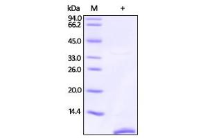 Human S100P, Tag Free on SDS-PAGE under reducing (R) condition. (S100P Protein (AA 1-95))
