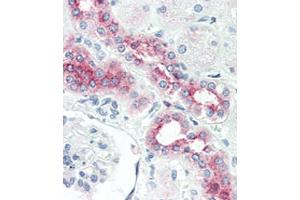 Formalin-fixed and paraffin-embedded human Kidney tissue reacted with BR2 antibody (N-term) (ABIN388741 and ABIN2850427) , which was peroxidase-conjugated to the secondary antibody, followed by AEC staining. (BMPR2 antibody  (N-Term))