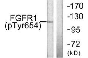 Western blot analysis of extracts from 293 cells treated with Insulin 0. (FGFR1 antibody  (pTyr654))