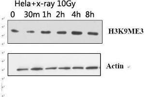 Western Blot (WB) analysis: Please contact us for more details. (Histone 3 antibody  (H3K9me3))