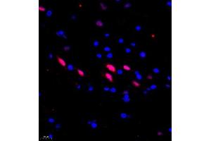 Immunofluorescence of paraffin embedded rat spinal cord using USP27 (ABIN7076113) at dilution of 1:1500 (400x lens) (USP27X antibody)