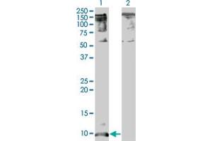 Western Blot analysis of CXCL5 expression in transfected 293T cell line by CXCL5 monoclonal antibody (M05A), clone 2A9.