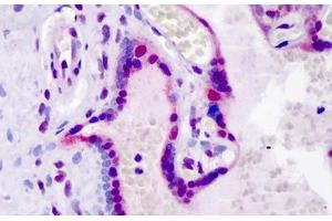 Human Placenta: Formalin-Fixed, Paraffin-Embedded (FFPE) (LEO1 antibody  (pSer10))