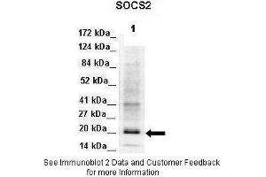 Lanes:  Lane 1: 50ug Mouse adipose lysate Primary Antibody Dilution:  1:1000 Secondary Antibody:  Donkey anti-Rabbit-HRP Secondary Antibody Dilution:  1:10000 Gene Name:  SOCS2 Submitted by:  Libin Liu, Boston University. (SOCS2 antibody  (C-Term))
