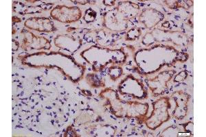 Formalin-fixed and paraffin embedded human kidney labeled with Anti-ATG101 Polyclonal Antibody, Unconjugated  at 1:300 followed by conjugation to the secondary antibody and DAB staining.