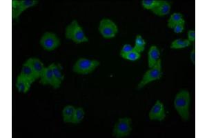 Immunofluorescence staining of HepG2 cells with ABIN7174068 at 1:166, counter-stained with DAPI. (SYK antibody  (AA 260-361))