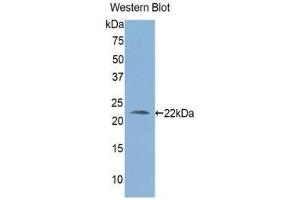 Western Blotting (WB) image for anti-Aldehyde Dehydrogenase 1 Family, Member A3 (ALDH1A3) (AA 332-509) antibody (ABIN1176368)