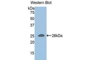 Western blot analysis of the recombinant protein. (ADAMTS1 antibody  (AA 258-467))