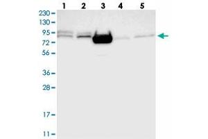 Western blot analysis of Lane 1: RT-4, Lane 2: U-251 MG, Lane 3: Human Plasma, Lane 4: Liver, Lane 5: Tonsil with FOXK1 polyclonal antibody  at 1:250-1:500 dilution. (Foxk1 antibody)