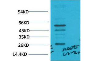 Western Blotting (WB) image for anti-Transforming Growth Factor, beta 1 (TGFB1) antibody (ABIN3181581)