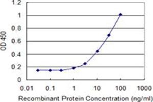 Detection limit for recombinant GST tagged MTMR1 is 0. (MTMR1 antibody  (AA 39-112))