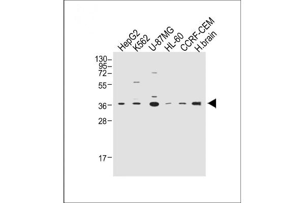 MPZ antibody  (C-Term)