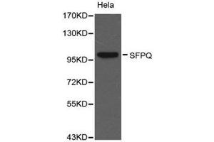 Western Blotting (WB) image for anti-Splicing Factor Proline/glutamine-Ric (SFPQ) antibody (ABIN1874752) (SFPQ antibody)