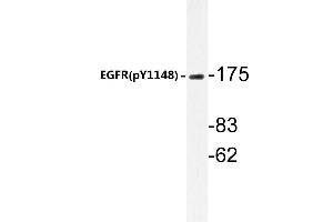 Western blot (WB) analyzes of p-EGFR antibody in extracts from HepG2 cells. (EGFR antibody  (pTyr1172))