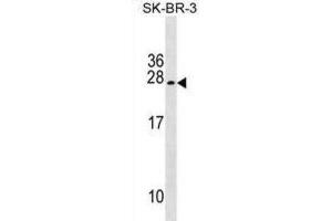Western Blotting (WB) image for anti-Tumor Suppressor Candidate 5 (TUSC5) antibody (ABIN2999811) (TUSC5 antibody)