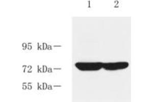 Western blot analysis of RASGRP3 (ABIN7075376) at dilution of 1: 1000,Lane 1:Rat liver tissue lysate,Lane 2: Rat kidney tissue lysate (RASGRP3 antibody)