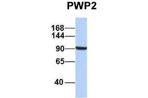 Host:  Rabbit  Target Name:  PWP2  Sample Type:  Jurkat  Antibody Dilution:  1. (PWP2 antibody  (Middle Region))