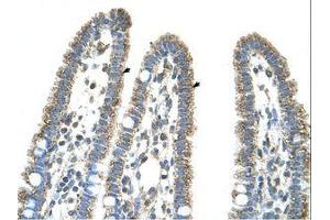 Image no. 1 for anti-Carbamoyl-Phosphate Synthase 1, Mitochondrial (CPS1) (AA 951-1000) antibody (ABIN320972) (CPS1 antibody  (AA 951-1000))