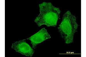 Immunofluorescence of monoclonal antibody to TIAM2 on HeLa cell. (TIAM2 antibody  (AA 527-624))