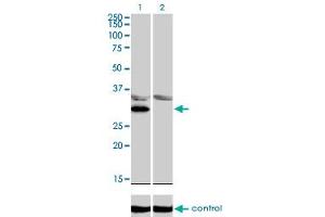 Western blot analysis of LDB3 over-expressed 293 cell line, cotransfected with LDB3 Validated Chimera RNAi (Lane 2) or non-transfected control (Lane 1). (LIM Domain Binding 3 Protein antibody  (AA 1-283))