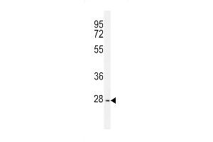 PTPN20A Antibody (Center) (ABIN655743 and ABIN2845189) western blot analysis in K562 cell line lysates (35 μg/lane). (PTPN20A antibody  (AA 178-207))