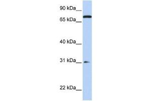 MAP4K1 antibody used at 1 ug/ml to detect target protein.