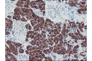 Image no. 1 for anti-Carboxypeptidase A2 (Pancreatic) (CPA2) antibody (ABIN1497595) (Carboxypeptidase A2 antibody)
