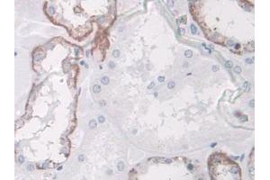DAB staining on IHC-P; Samples: Human Kidney Tissue (SPARCL1 antibody  (AA 298-545))