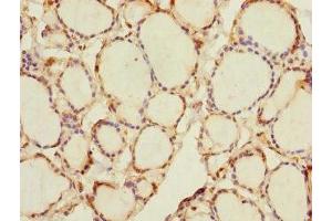 Immunohistochemistry of paraffin-embedded human thyroid tissue using ABIN7168008 at dilution of 1:100