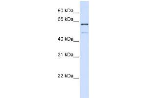 WB Suggested Anti-METT10D Antibody Titration:  0.
