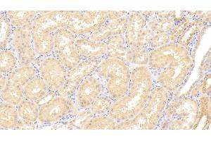 Detection of ADAMTS9 in Human Kidney Tissue using Polyclonal Antibody to A Disintegrin And Metalloproteinase With Thrombospondin 9 (ADAMTS9) (ADAMTS9 antibody  (AA 1727-1935))