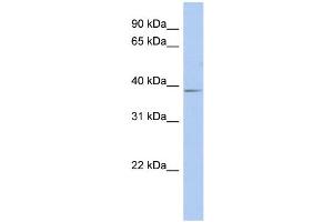 WB Suggested Anti-SLC25A28 Antibody Titration:  0. (SLC25A28 antibody  (Middle Region))