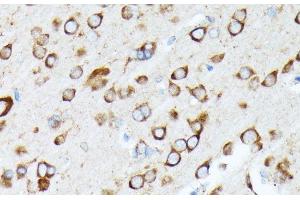 Immunohistochemistry of paraffin-embedded Rat brain using RPL7 Polyclonal Antibody at dilution of 1:100 (40x lens). (RPL7 antibody)