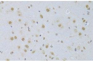 Immunohistochemistry of paraffin-embedded Rat brain using CDKN1A Polyclonal Antibody at dilution of 1:100 (40x lens).