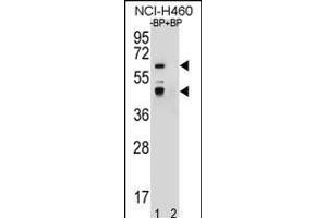Western blot analysis of PREF3 Antibody (C-term) Pab (ABIN656587 and ABIN2845849) pre-incubated without(lane 1) and with(lane 2) blocking peptide in NCI- cell line lysate. (PRAMEF3 antibody  (C-Term))