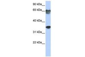 Image no. 1 for anti-NK3 Homeobox 2 (NKX3-2) (N-Term) antibody (ABIN6740332) (NKX3-2 antibody  (N-Term))