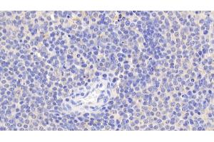 Detection of Bid in Human Spleen Tissue using Polyclonal Antibody to BH3 Interacting Domain Death Agonist (Bid) (BID antibody  (AA 1-195))