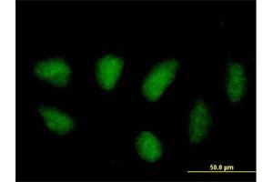 Immunofluorescence of purified MaxPab antibody to MAPK11 on HeLa cell. (MAPK11 antibody  (AA 1-364))