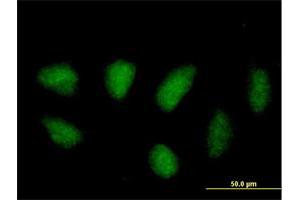 Immunofluorescence of purified MaxPab antibody to MAPK11 on HeLa cell. (MAPK11 antibody  (AA 1-364))