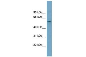 WB Suggested Anti-SLC22A15 Antibody Titration:  0. (SLC22A15 antibody  (Middle Region))
