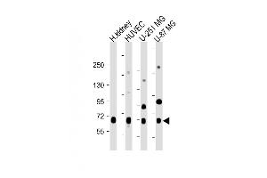 All lanes : Anti-NOX4 Antibody (N-term) at 1:2000 dilution Lane 1: Human kidney lysate Lane 2: HUVEC whole cell lysate Lane 3: U-251 MG whole cell lysate Lane 4: U-87 MG whole cell lysate Lysates/proteins at 20 μg per lane. (NADPH Oxidase 4 antibody  (N-Term))